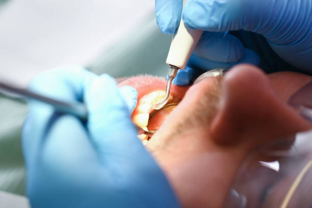 Best Emergency Dental Services for Seniors in Homewood, AL